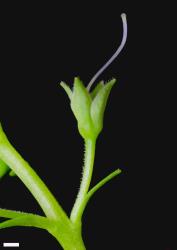 Veronica catarractae. Pedicel, showing hairs in a single row, and calyx. Scale = 1 mm.
 Image: P.J. Garnock-Jones © P.J. Garnock-Jones CC-BY-NC 3.0 NZ